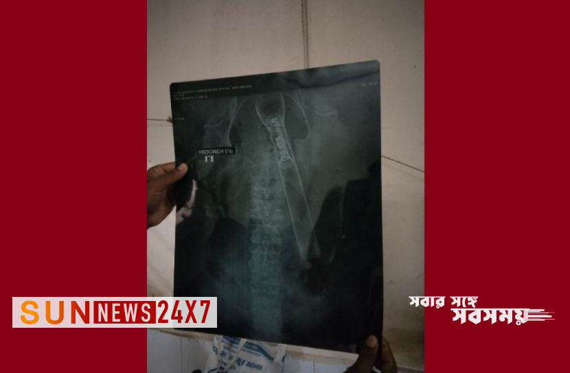 বাংলাদেশঃ বৃদ্ধের পায়ু পথে টর্চলাইট ডুকিয়ে নির্যাতন বাংলাদেশঃ বৃদ্ধের পায়ু পথে টর্চলাইট ডুকিয়ে নির্যাতন