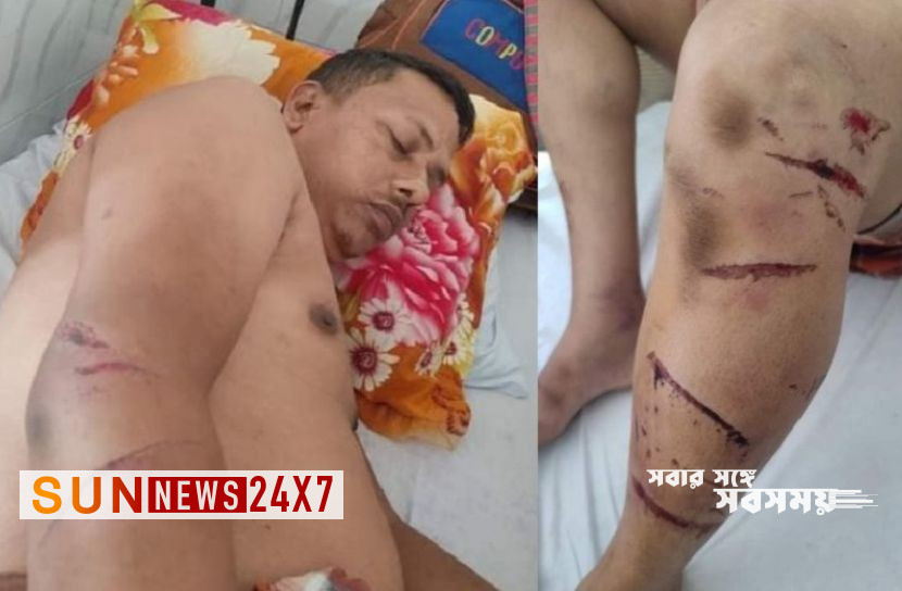 বাংলাদেশঃ সন্ত্রাসী হামলায় ব্যবসায়ী আহত বাংলাদেশঃ সন্ত্রাসী হামলায় ব্যবসায়ী আহত