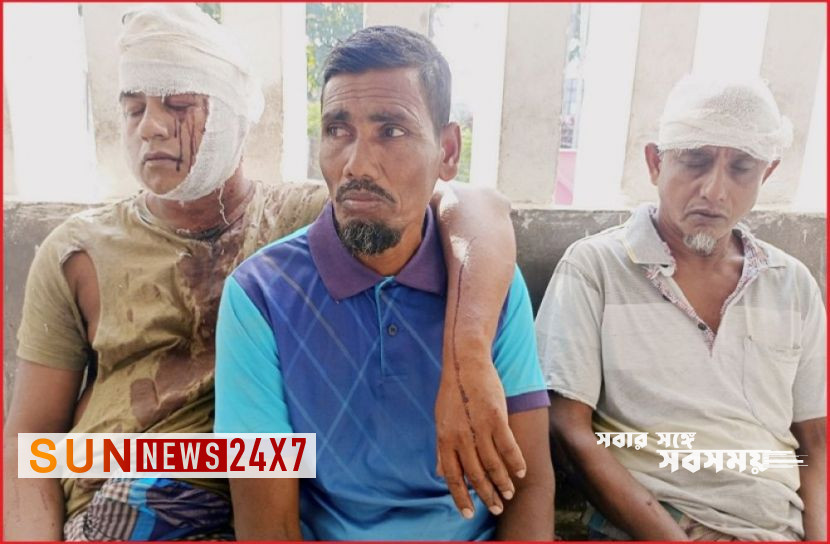 মোরেলগঞ্জে প্রতিপক্ষের হামলায় আহত ২ মোরেলগঞ্জে প্রতিপক্ষের হামলায় আহত ২