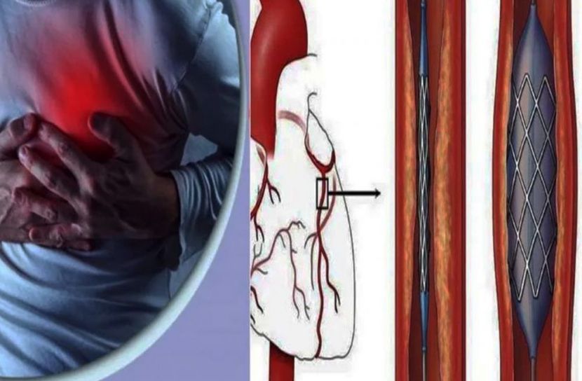 হার্টের রিংয়ে ২০ হাজার, চোখের লেন্সে ৫ হাজার টাকা পর্যন্ত খরচ কমতে পারে 