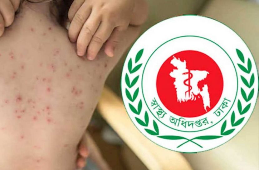 ২৪ ঘণ্টায় হামের উপসর্গ নিয়ে ৪ শিশুর মৃত্যু