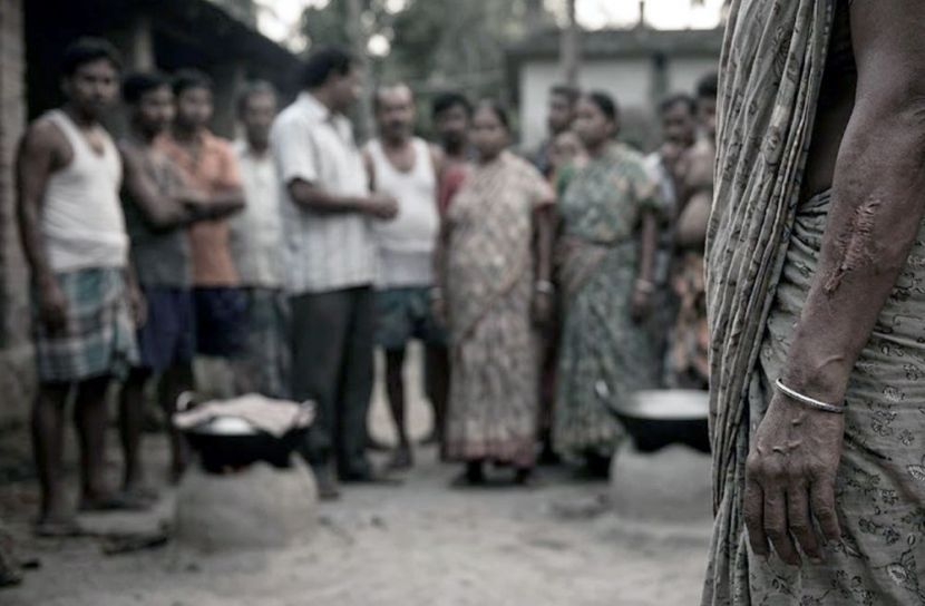 কড়াইয়ের ছ্যাঁকা আর এক সমাজের নীরবতা 