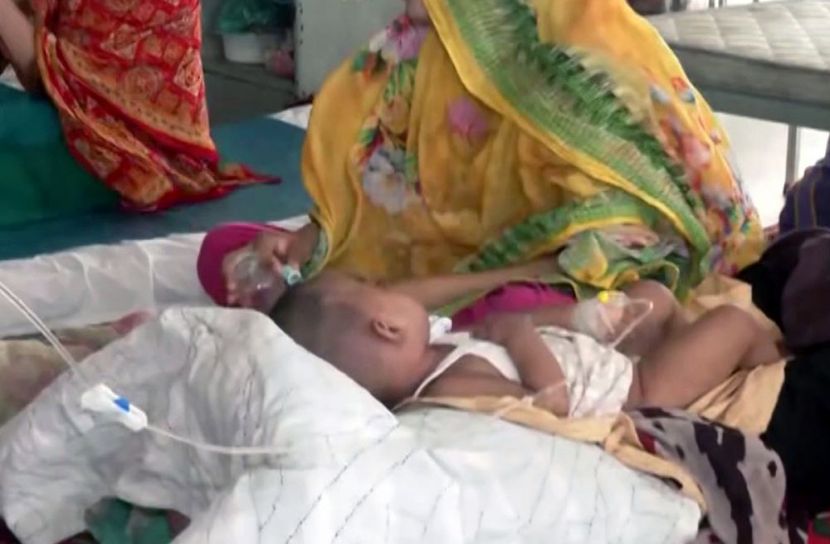 হামের প্রকোপে ২৪ ঘণ্টায় আক্রান্ত আরও ৮৩৩ শিশু, মৃত্যু ২