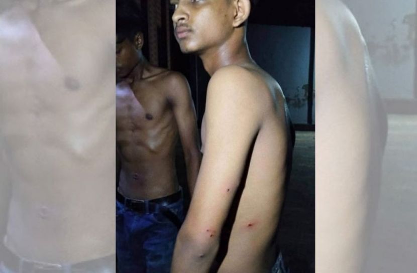 নোয়াখালীতে মুখোশধারীদের গুলিতে ছাত্রশিবির কর্মীসহ গুলিবিদ্ধ ৩