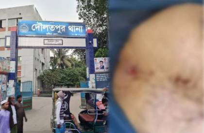 ছবি: সান নিউজ